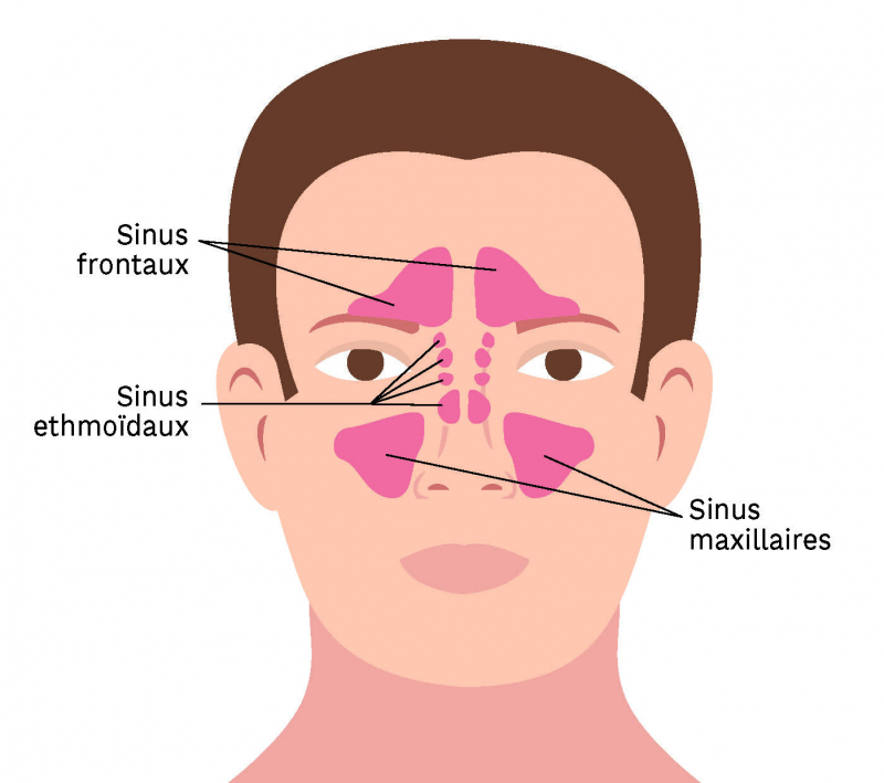Les sinus frontaux, ethmoïdaux et maxillaires